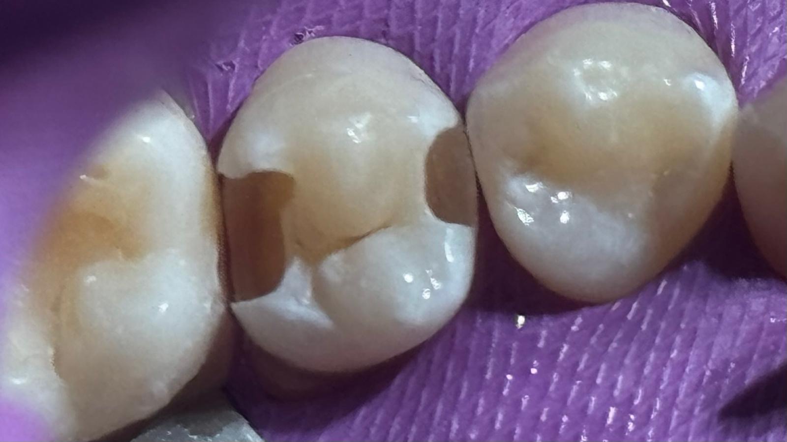 Dental Assistant Texas